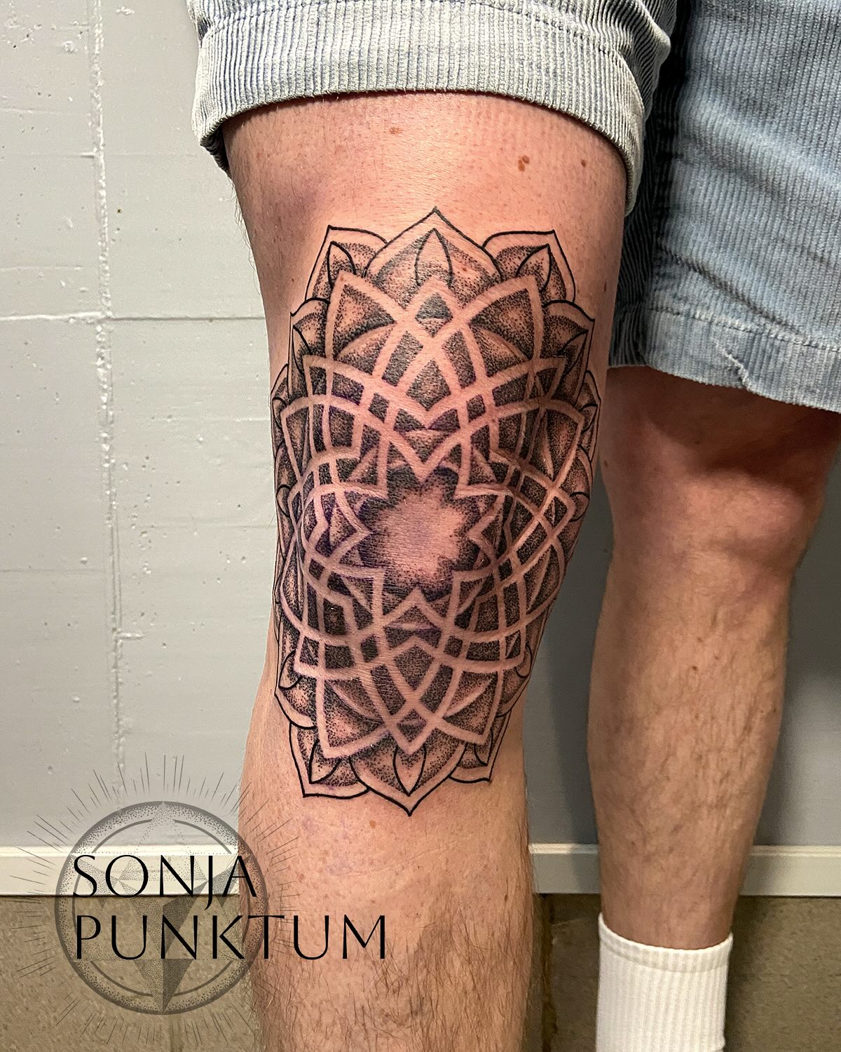 .
Mandala fürs Knie
.
Eigentlich wollten wir ja den Arm weiter machen, aber den